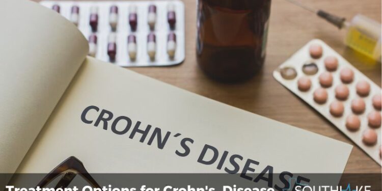 Is There a Cure for Crohns Disease? Expert Insights
