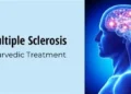 Best Multiple Sclerosis Treatments Approved Worldwide: A Comprehensive Guide