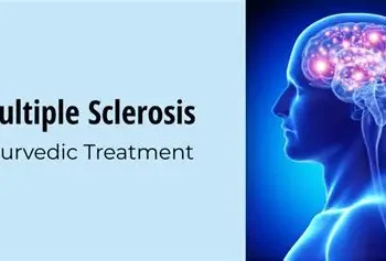 Best Multiple Sclerosis Treatments Approved Worldwide: A Comprehensive Guide